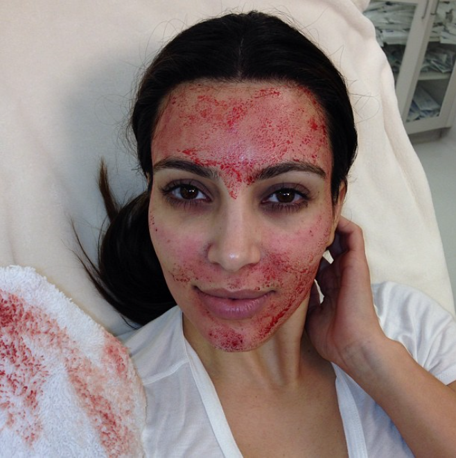 Kim Kardashian and the Allure of the Vampire Facial